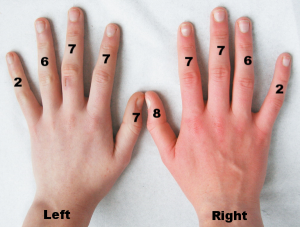 Ring Splint Sizing 2016